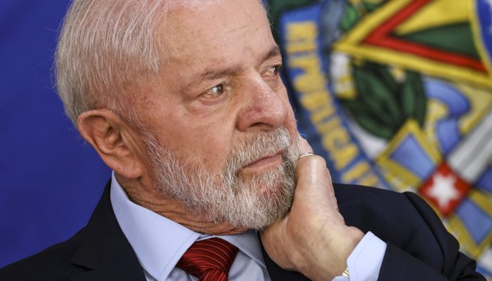 158864,lula-passara-por-complementacao-da-cirurgia-na-cabeca-informa-equipe-medica-3