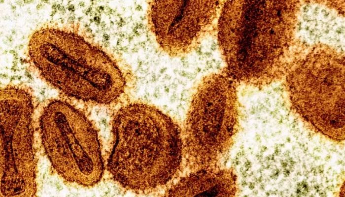 162239,ministerio-da-saude-confirma-primeiro-caso-da-nova-cepa-do-virus-mpox-3